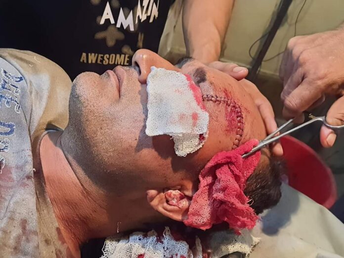 Polish_20230718_191637675