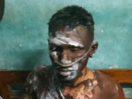 অভয়নগরে বিয়ের প্রস্তাব প্রত্যাখান, নিজের গায়ে পেট্রল ঢেলে আগুন প্রেমিকের