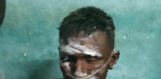 অভয়নগরে বিয়ের প্রস্তাব প্রত্যাখান, নিজের গায়ে পেট্রল ঢেলে আগুন প্রেমিকের